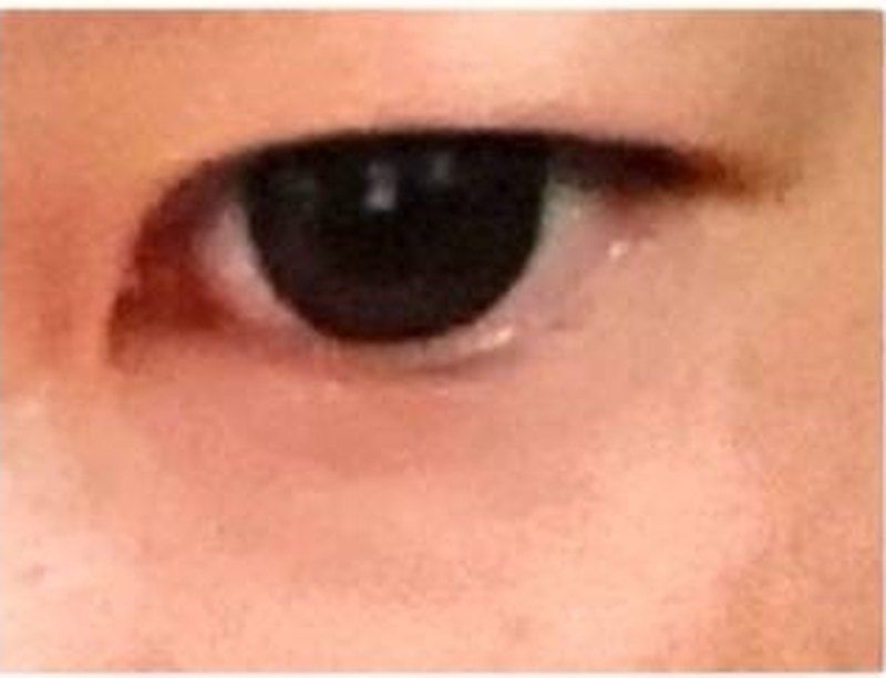 一重のまぶたの写真